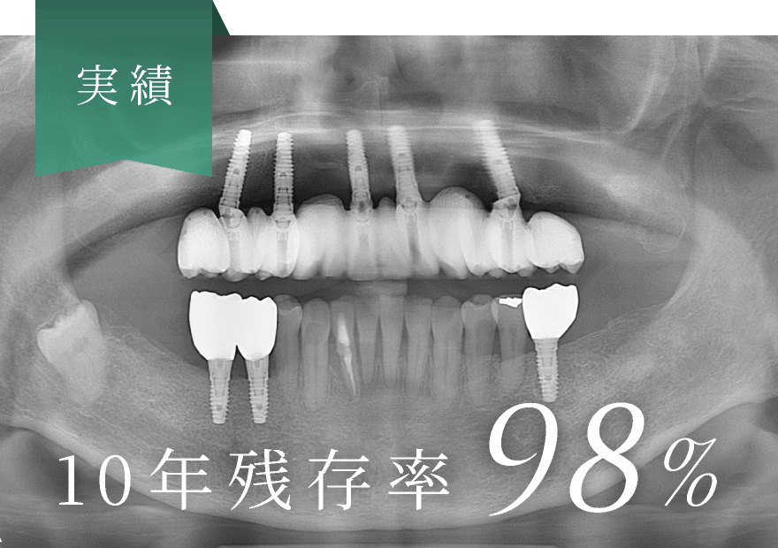 10年残存率98%