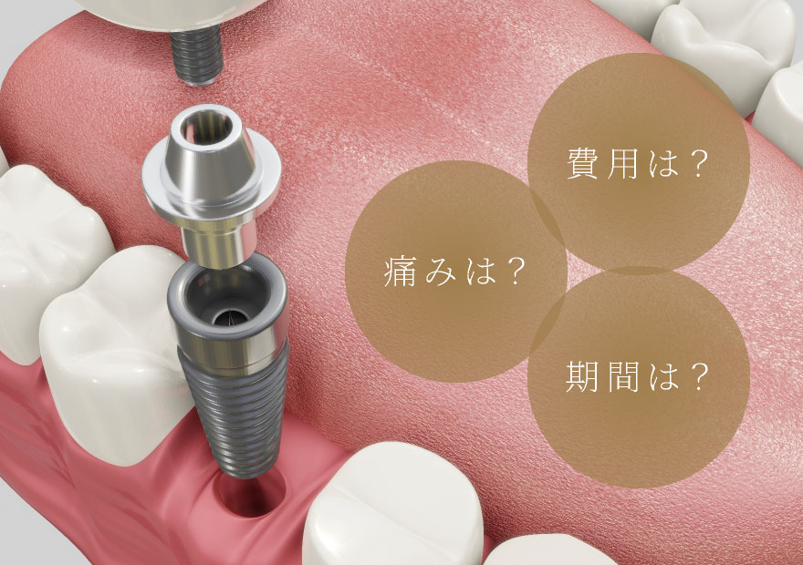 費用は?、痛みは?、期間は?