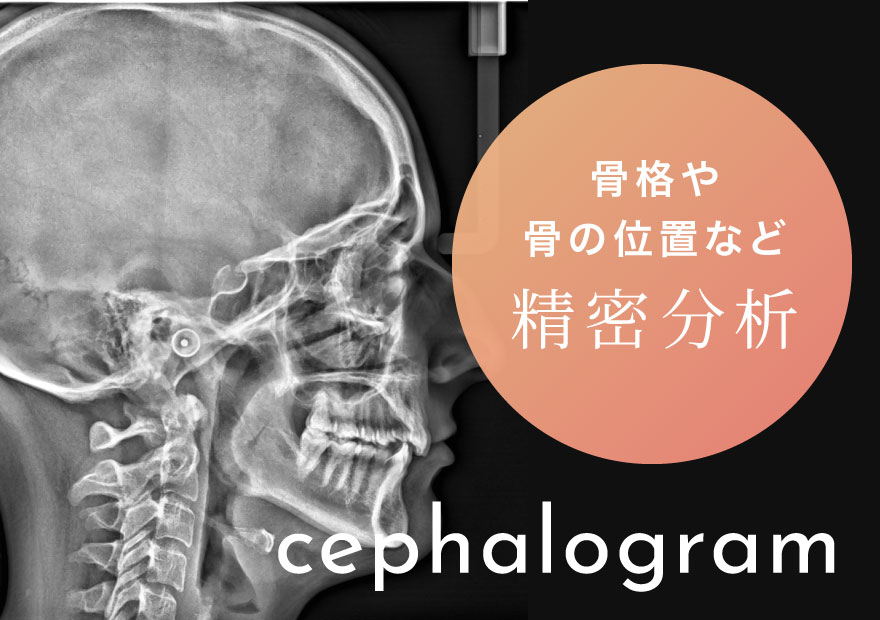 骨格や骨の位置など精密分析