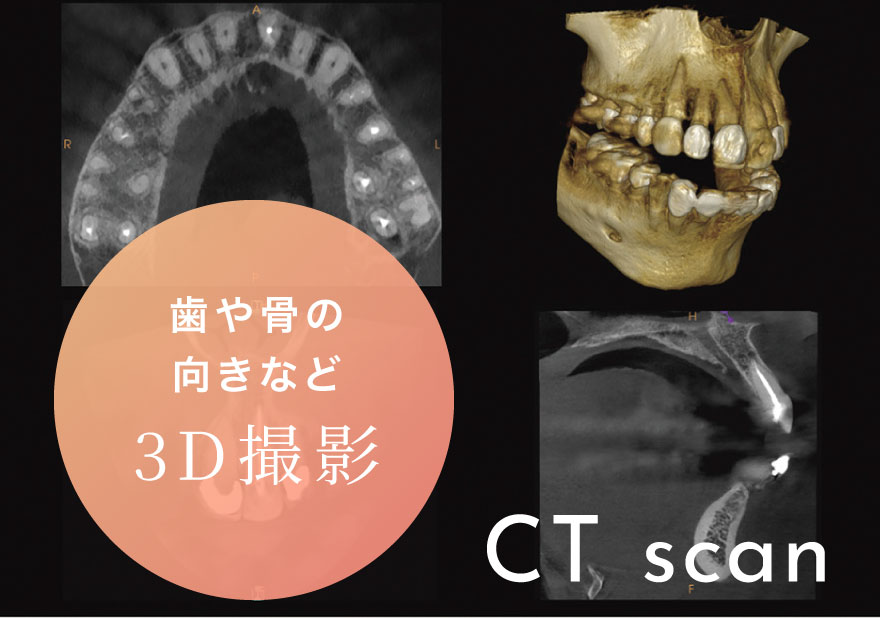 歯や骨の向きなど3D撮影