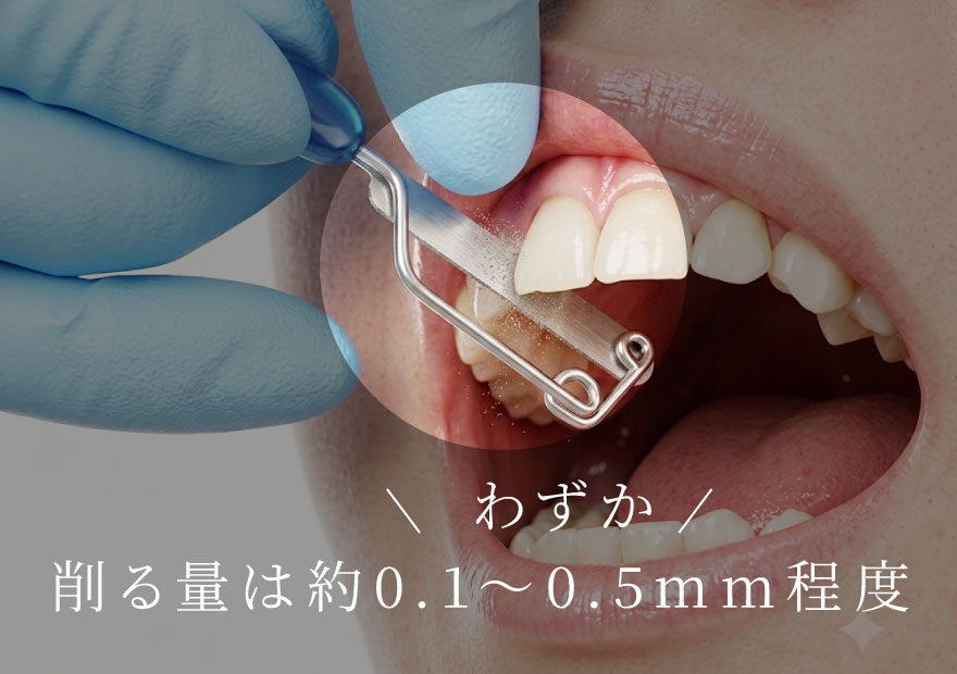 削る量はわずか約0.1〜0.5mm程度
