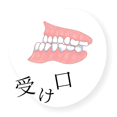 受け口