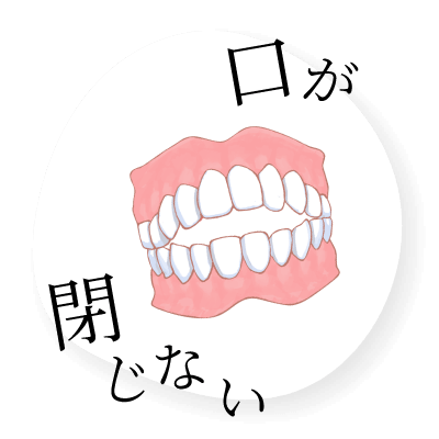 口が閉じない