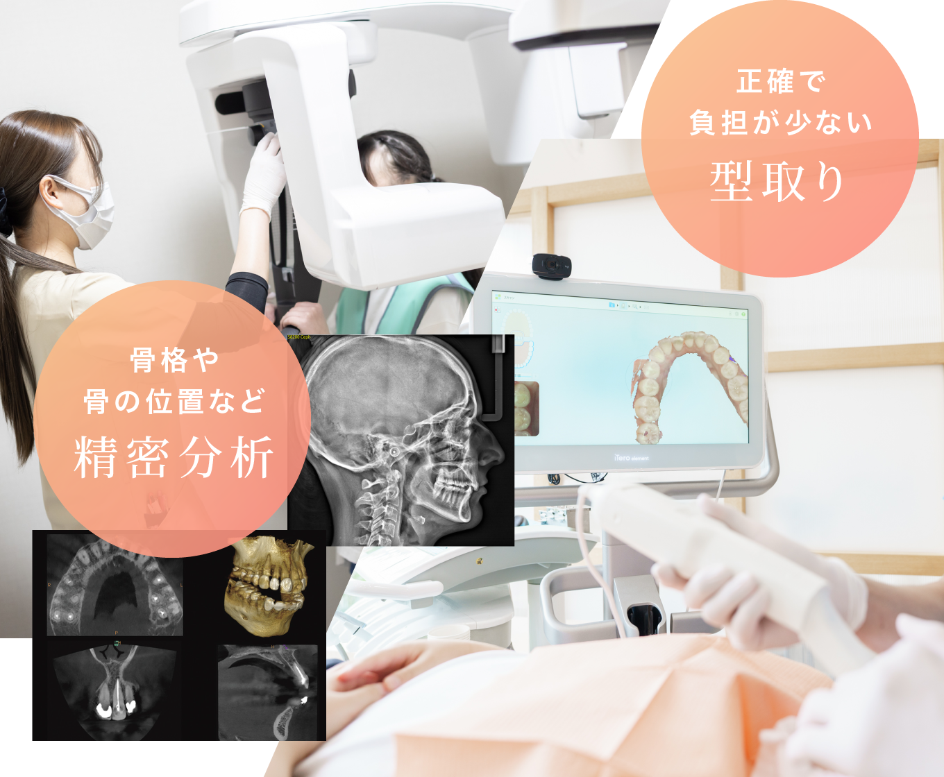 骨格や骨の位置など精密分析/正確で負担が少ない型取り